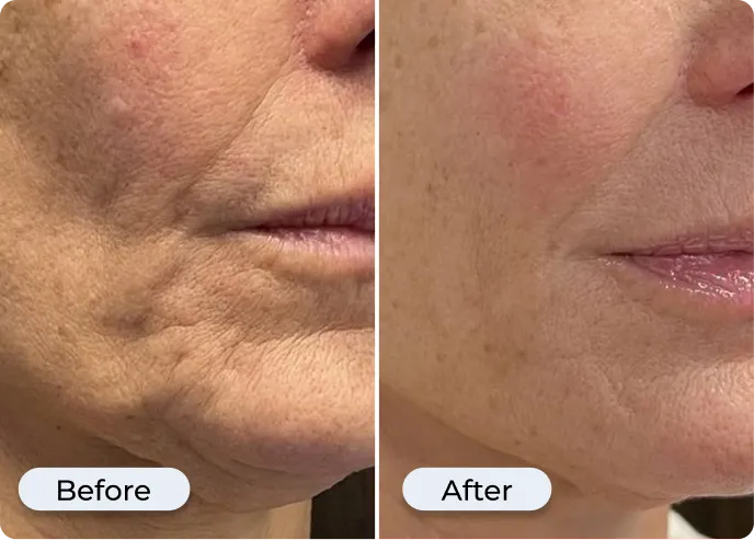 Real customer before and after