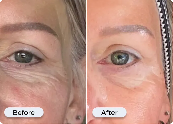 Real customer before and after