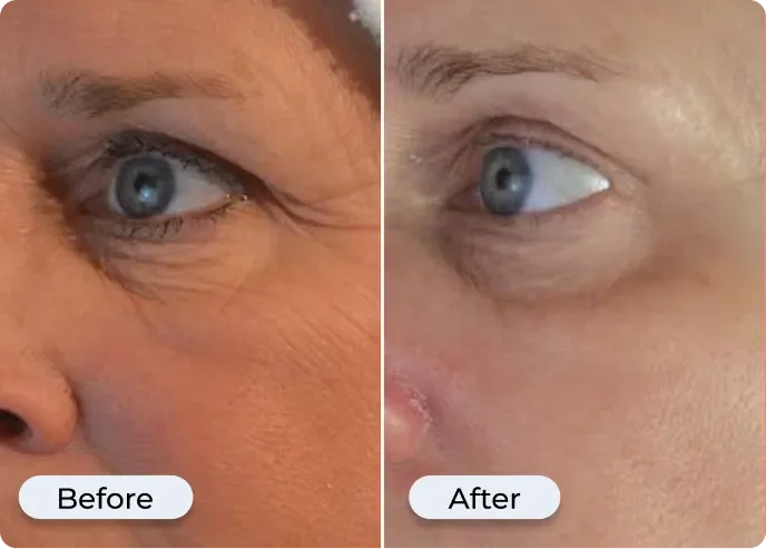 Before and after