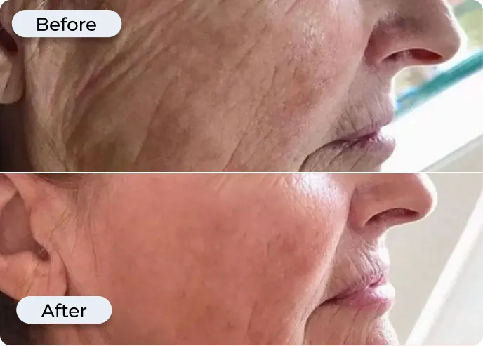 Before and after